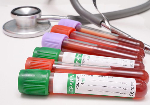 blood and laboratory testing
