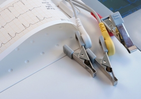 electrocardiogram or ekg